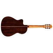 Horizontal back view of Orchestra CE Teardrop Burst thumb